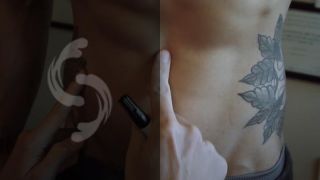 lipoescultura abdominal buenos aires Ricardo Babaitis - Cirujano Plástico experto en tecnología láser y lipoescultura de alta definición