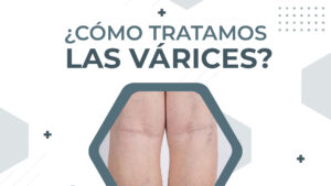 medicos angiologia cirugia vascular buenos aires UQV - Unidades Quirúrgicas Vasculares. Cirugía Vascular. Flebología. Pie diabético. Tratamientos laser. Várices. Doctor Pardo