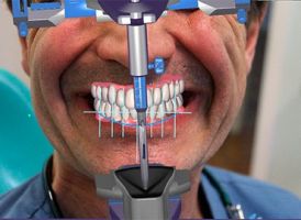 periodoncista buenos aires Oral Health Odontologia - Implantes Dentales Buenos Aires