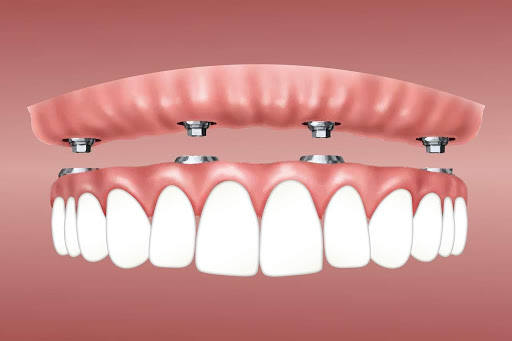 Odontología Estética Dental Juri