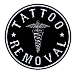 lugares para eliminar tatuajes en buenos aires Tattoo Removal